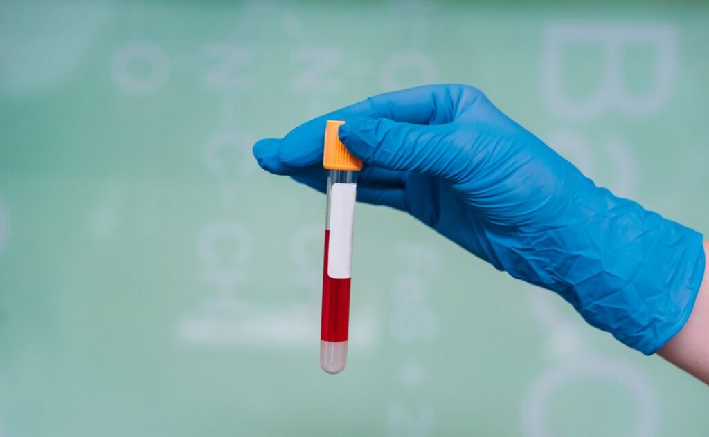 Complete Blood Picture (CBP) Test in hastinapuram