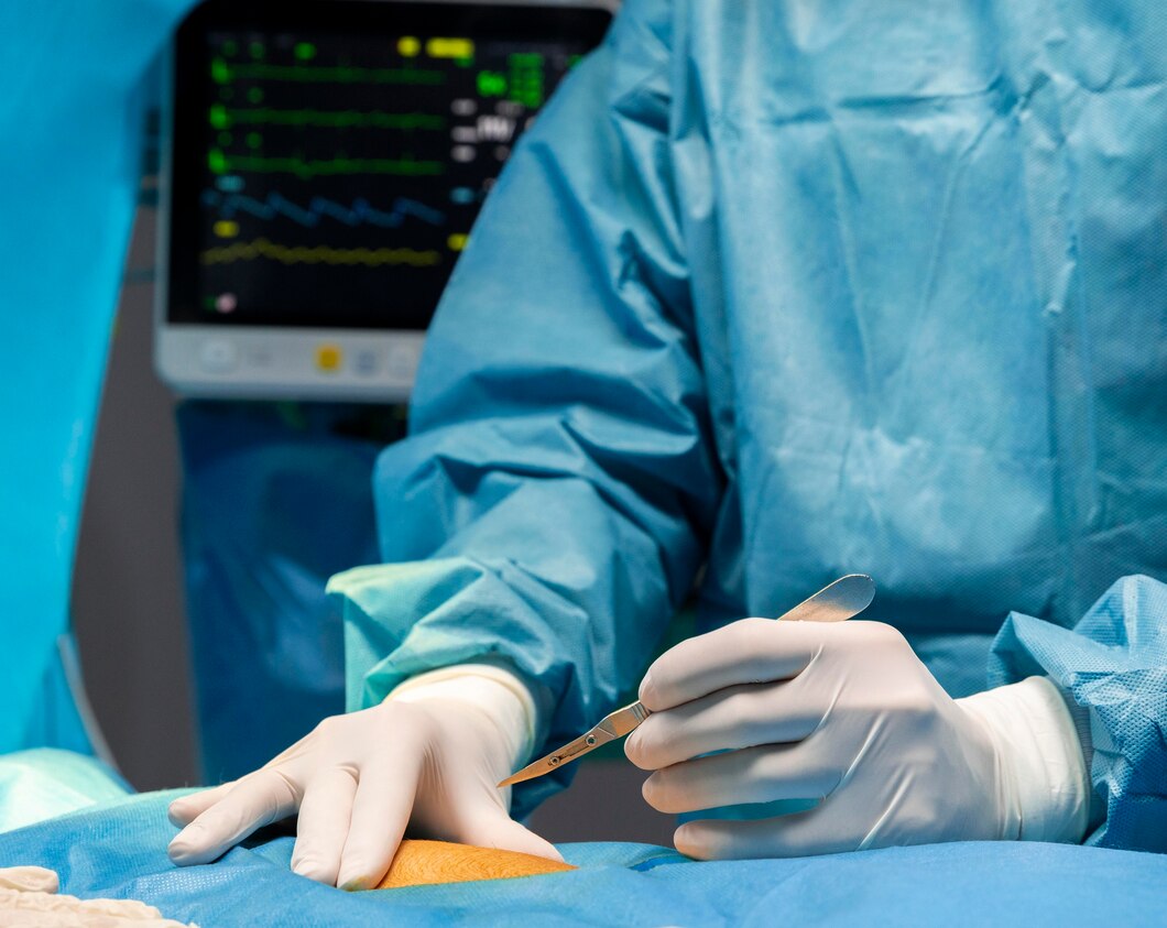 USG-Guided Abscess Drainage - Catheter Placement in hastinapuram