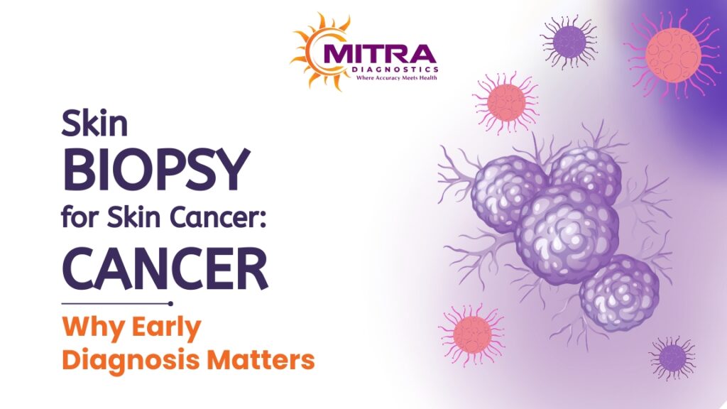Skin Biopsy for skin cancer