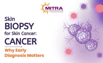 Skin Biopsy for skin cancer