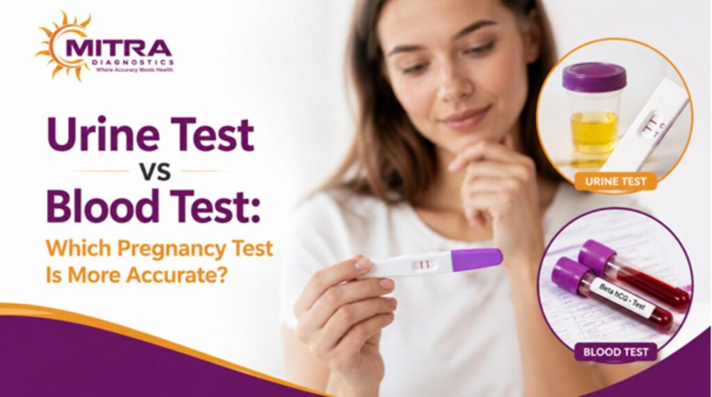 Pregnancy test